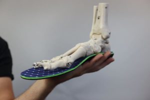 Top of the foot pain best orthotics