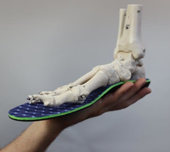 Top of the foot pain best orthotics
