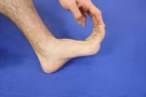 Turf Toe Causes Turf Toe Recovery Time