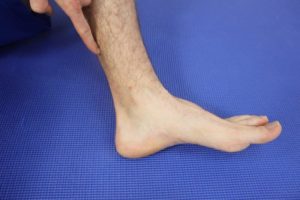 Achilles Tendonitis Heel Pain After Running