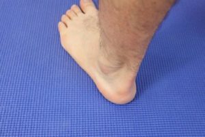 Posterior Heel Pain 2 Posterior Heel Pain: Causes & Best Treatment 2020!
