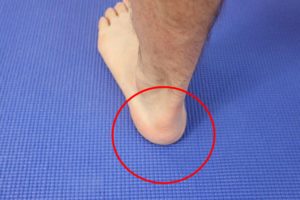 Heel Pain In Children 2 Heel Pain In Children: Causes & Best Treatment 2020!