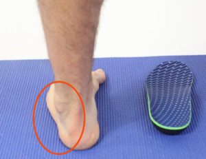 outside foot pain