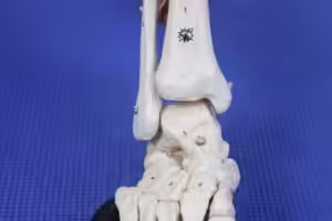 Sprained Foot & Ankle Healing Time