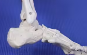 Sinus Tarsi Pain Outside of the Ankle