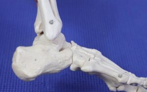 Pain On Outside Of Ankle 6 Sinus Tarsi Pain Outside of the Ankle