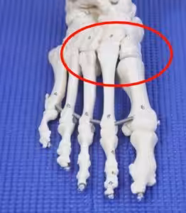 Bone Spur on top of the foot causes
