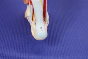 Shockwave therapy for Achilles tendonitis 