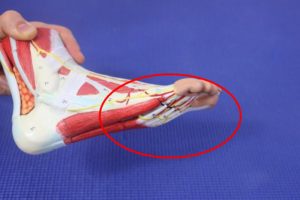 Sore spot on the ball of the foot causes, symptoms treatment