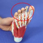 Middle Toe Pain: Causes, Symptoms & Best Home Treatment