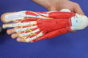 Painful Lump in the Arch of My Foot 2 Painful Lump in the Arch of My Foot: Complete Home Treatment Guide!