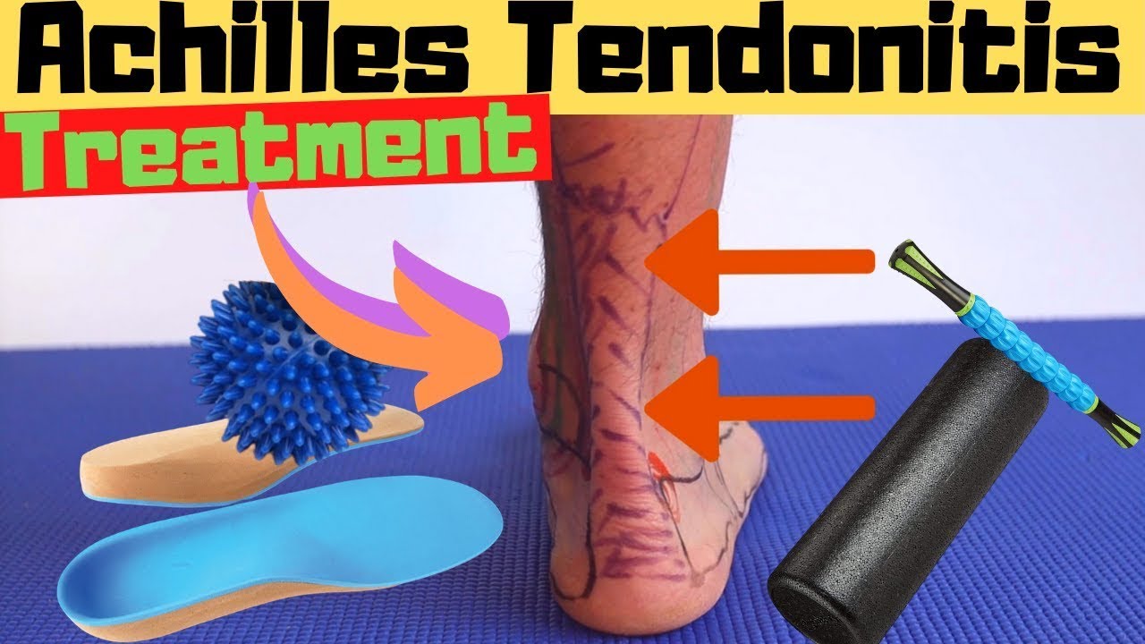 achilles tendon heel pain treatment