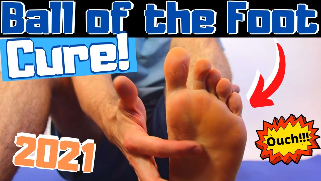 foot doctor ball foot pain