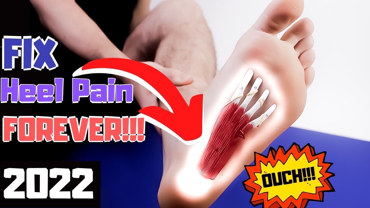 foot doctor plantar fasciitis treatment