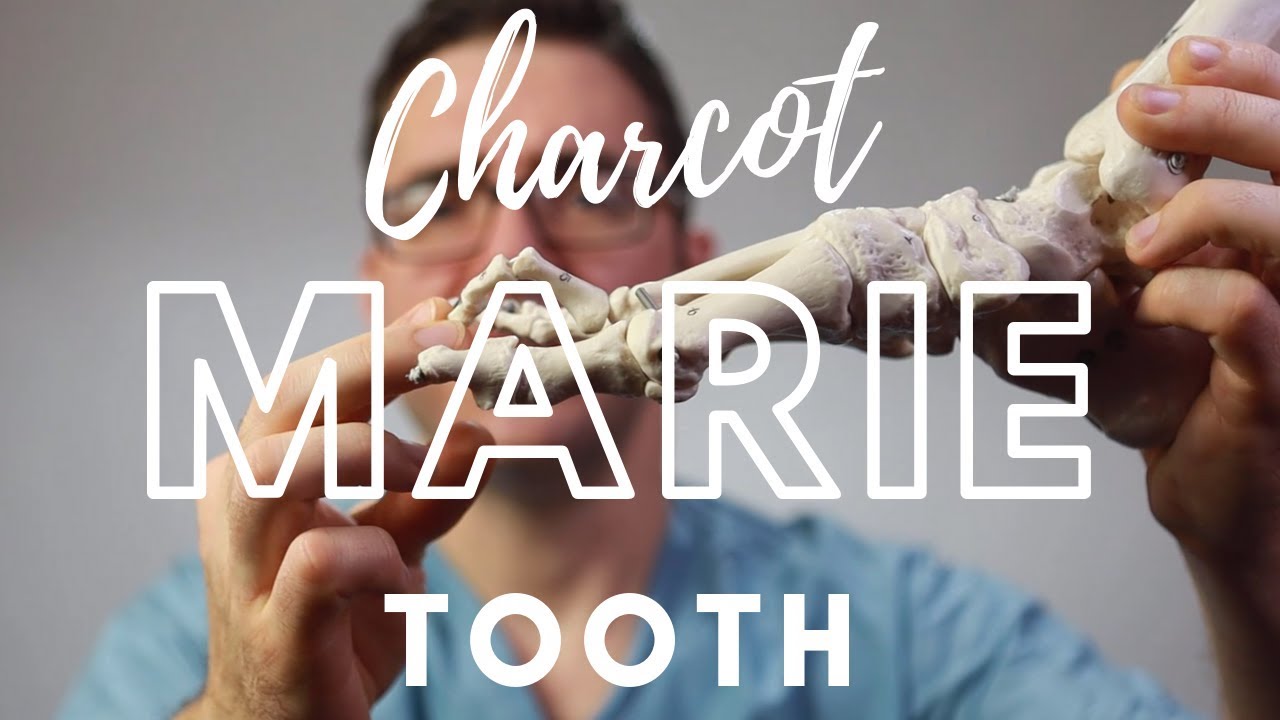 charcot marie tooth syndrome