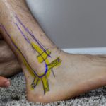 Recommended Foot Doctor Products 11 A walking book or medical boot can be a great solution for a sprained ankle or ankle injury