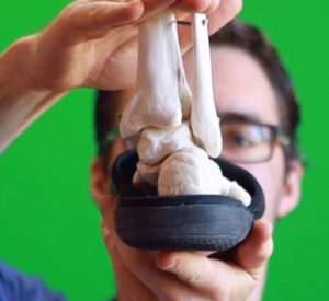 Heel pain after running 5 Best sandals for overpronation and flat feet