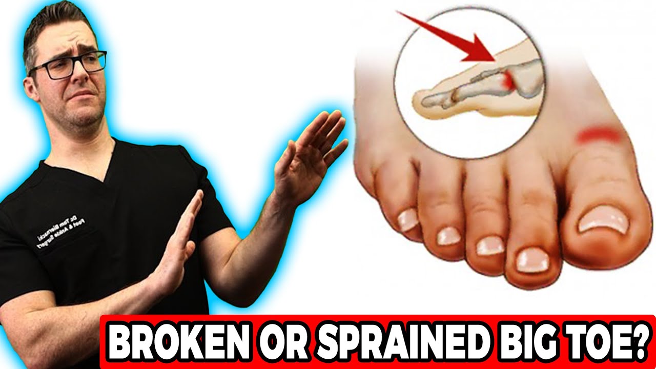 broken big toe