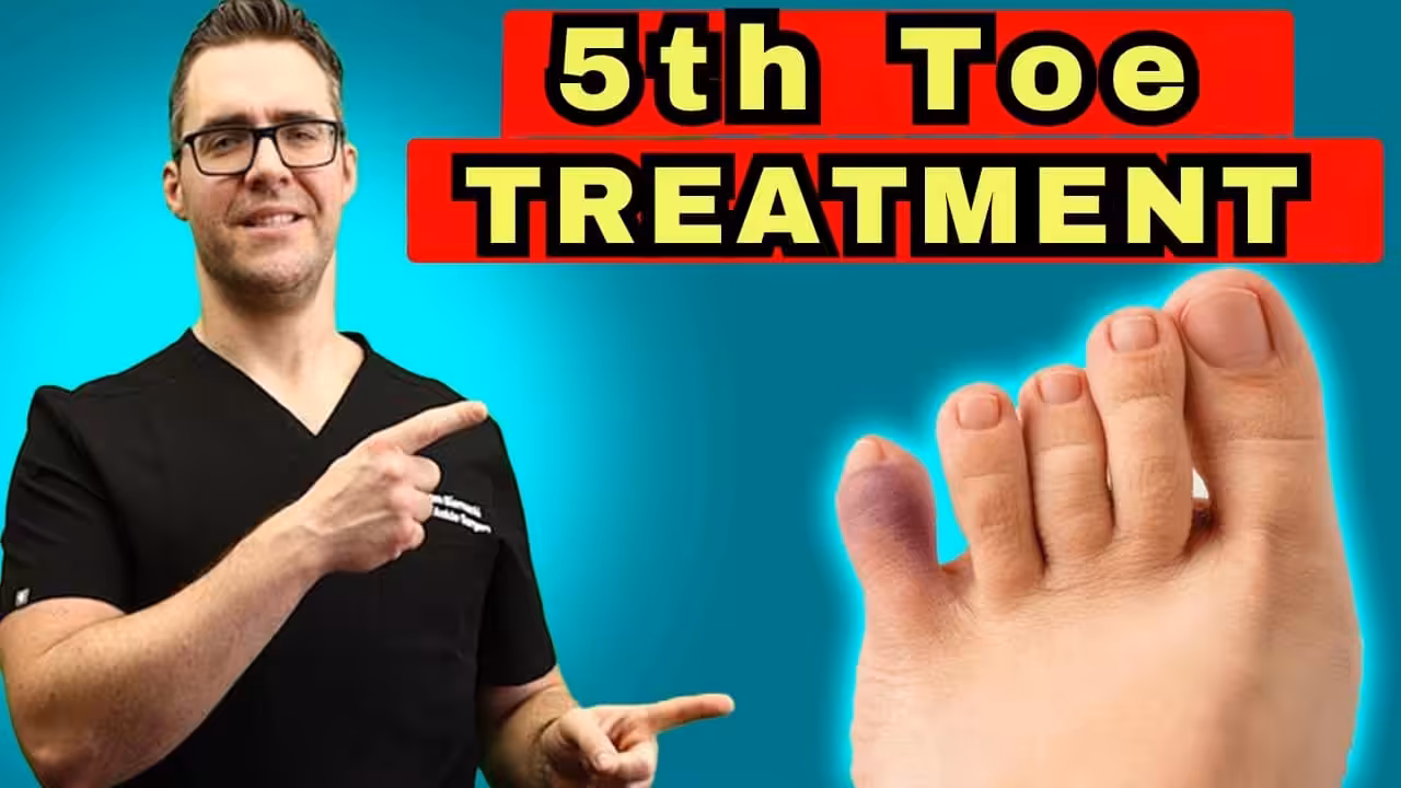 Broken Pinky Toe