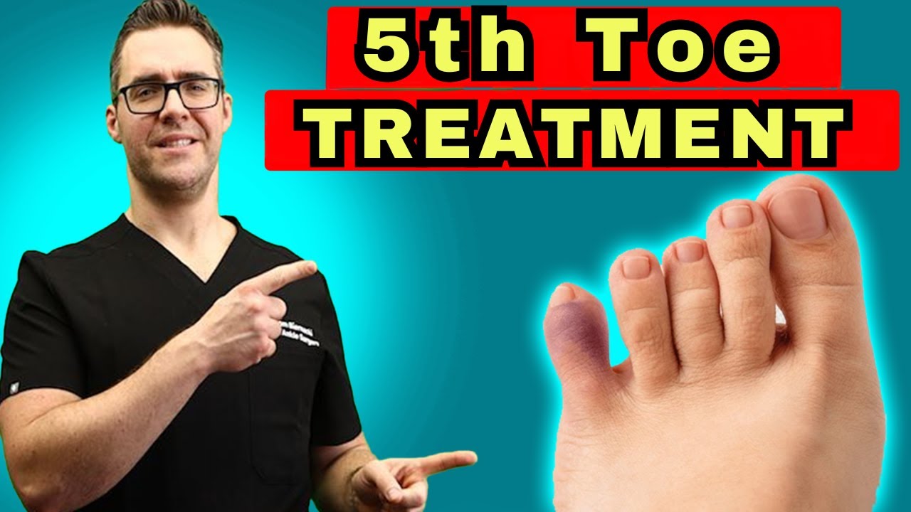 broken pinky toe