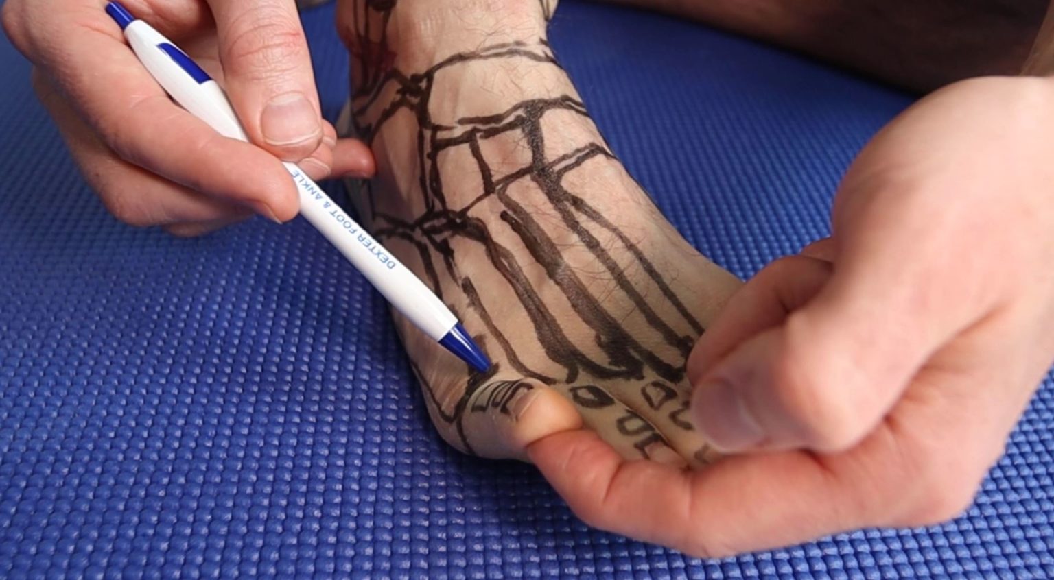 Pain on Outside of Foot Near Little Toe [Causes & Best Treatment]