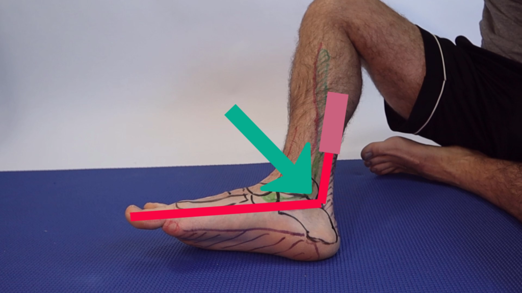 FHL tendonitis and posterior tibial tendonitis