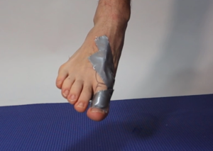 Turf Toe Best Treatment Taping