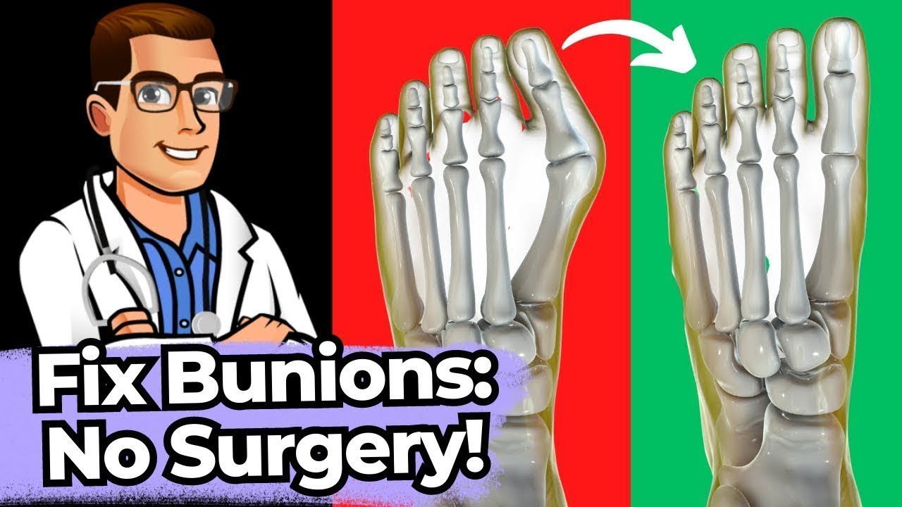 bunion big toe joint