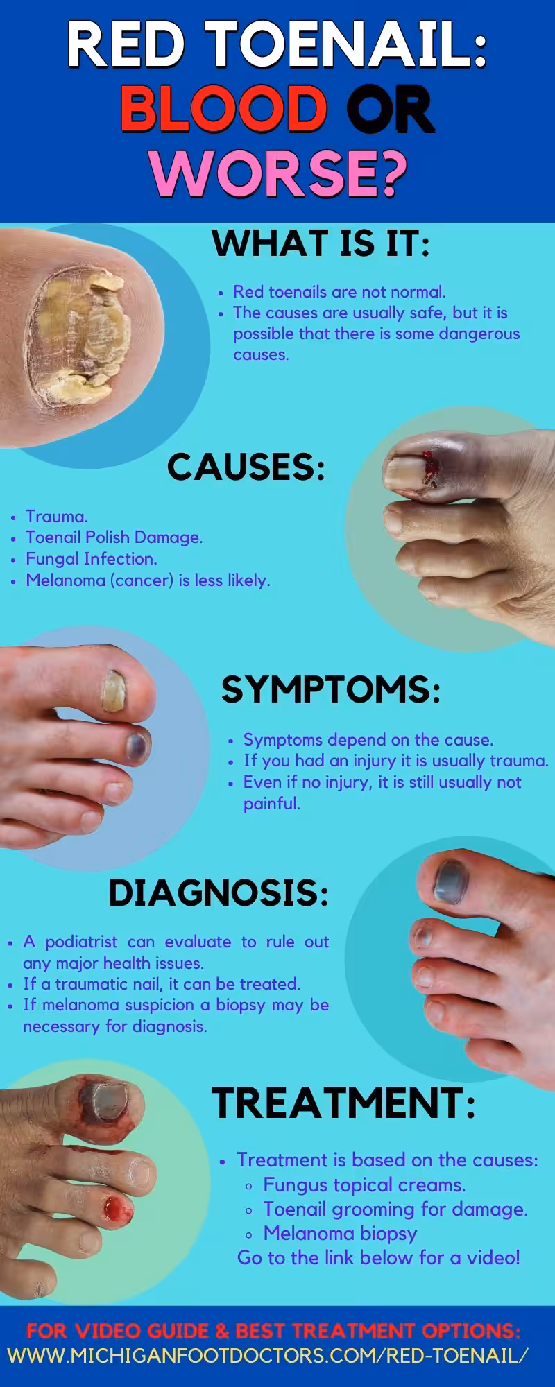 red spot under toenail & red spot under nail