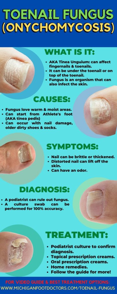toenail fungus onychomycosis toenail infection