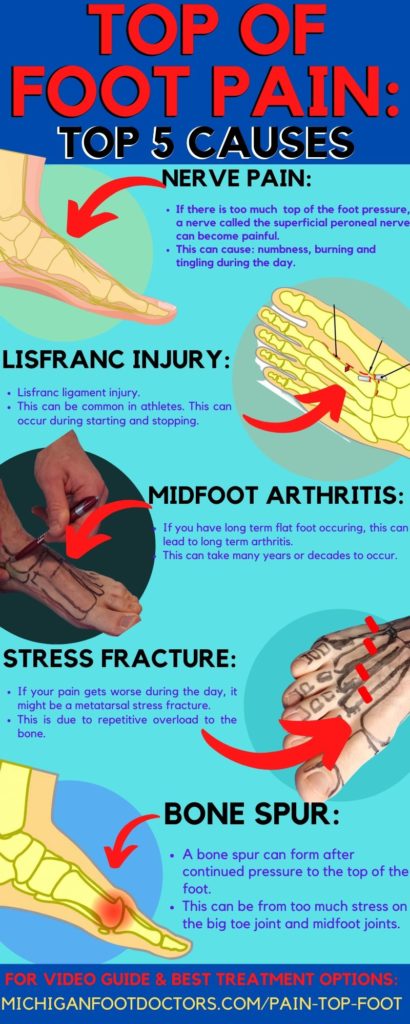 dorsal foot pain treatment