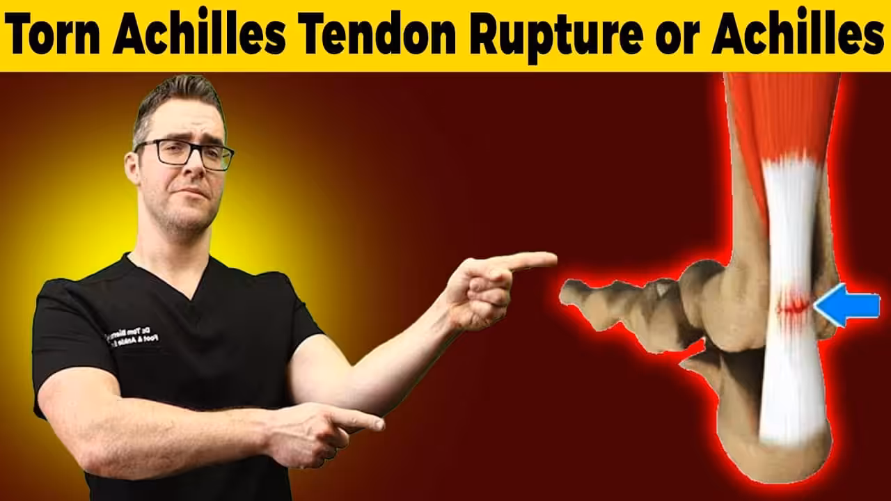 Torn Achilles Tendon Video