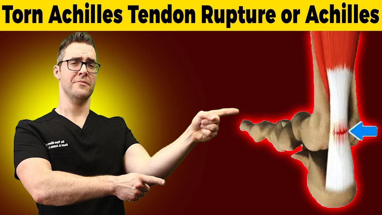 torn achilles tendon video