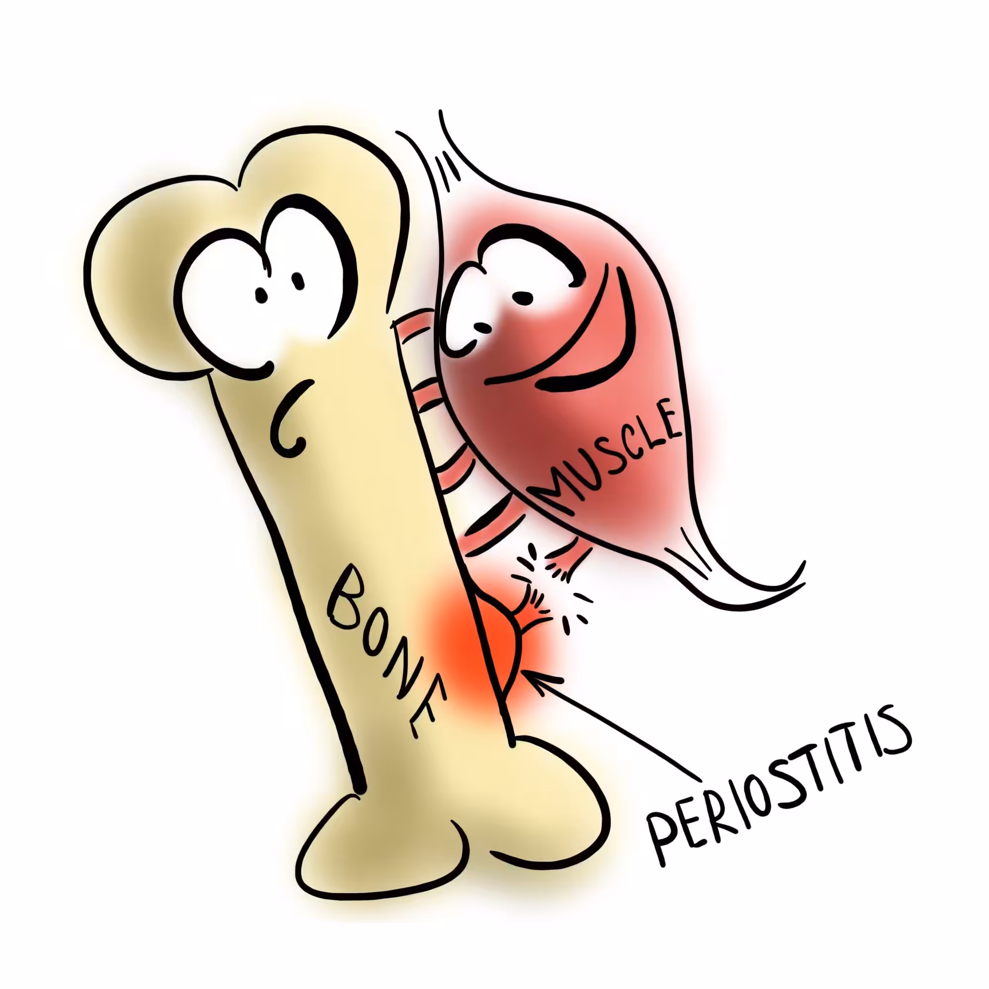 Periostitis or shin splints
