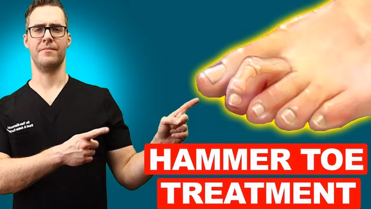 Swollen Middle Toe Joint