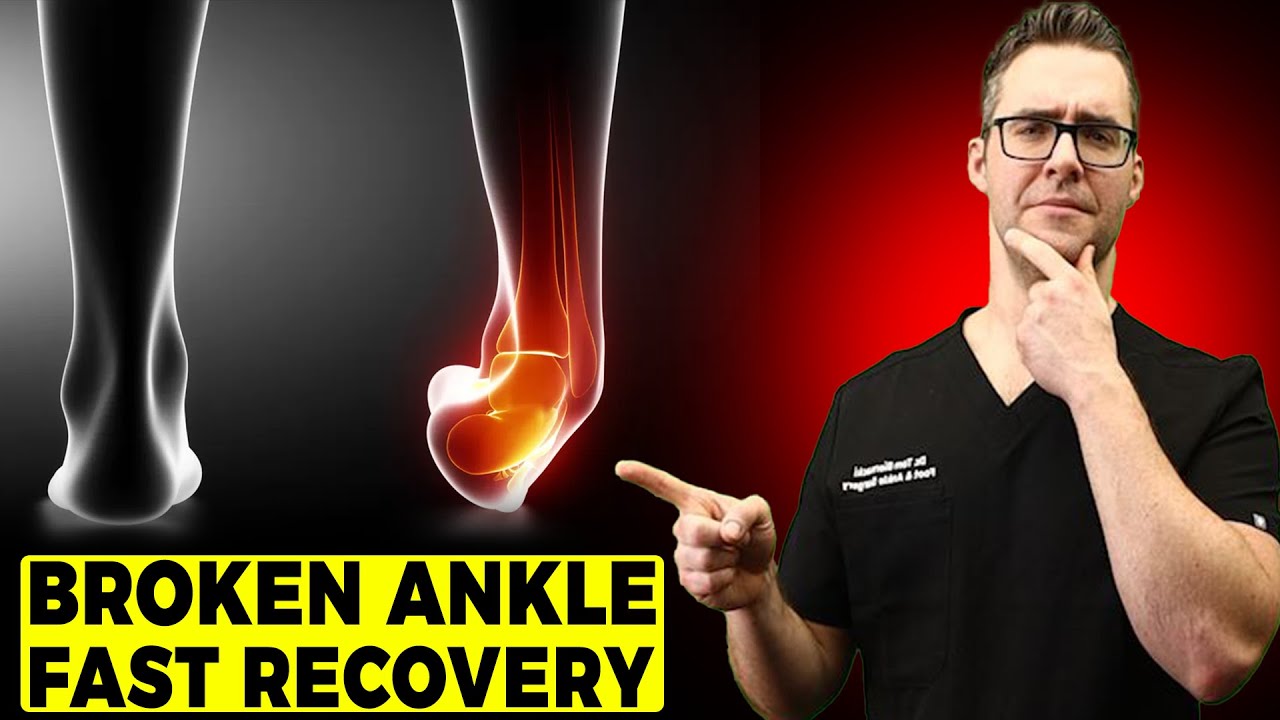 broken ankle recovery