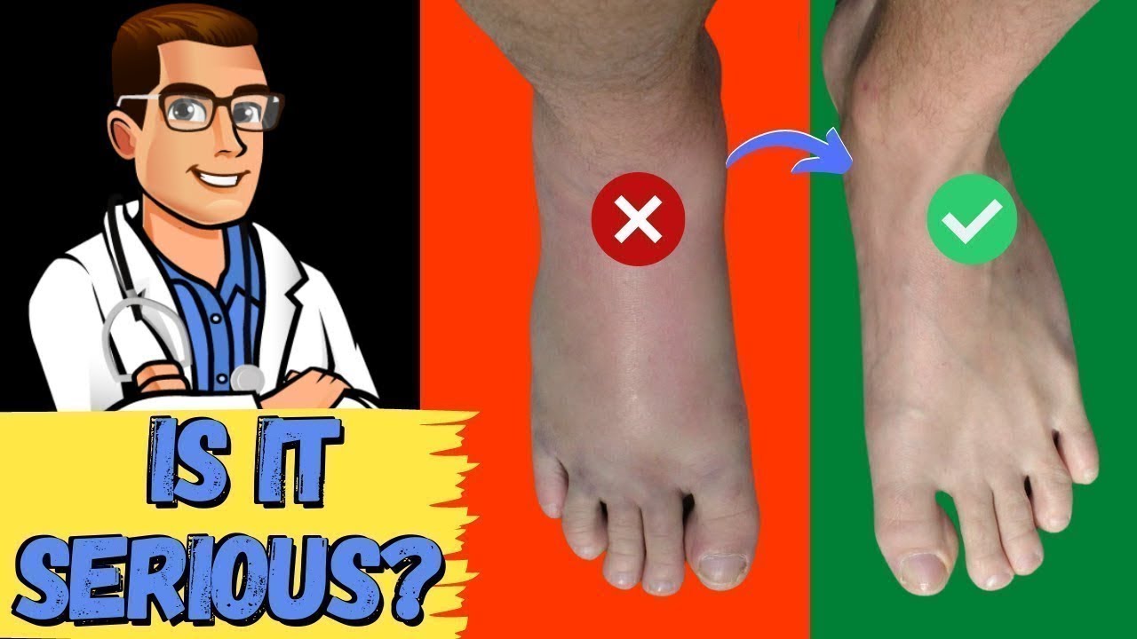 How To Tell If My Foot Or Ankle Injury Is Bad! | Balance Foot & Ankle