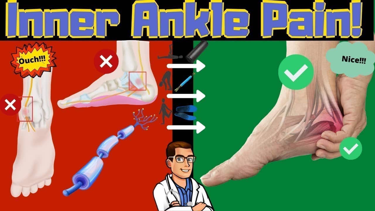 inside of the ankle pain tarsal tunnel syndrome treatment amp symptoms