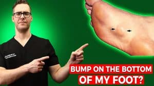 Plantar Fibroma Treatment & Massage