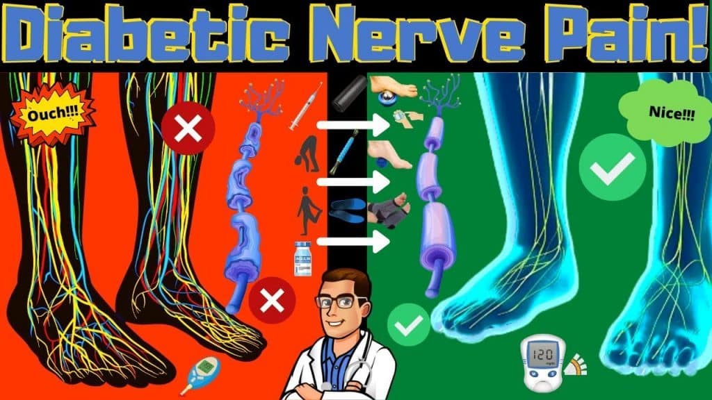 diabetic peripheral neuropathy treatment