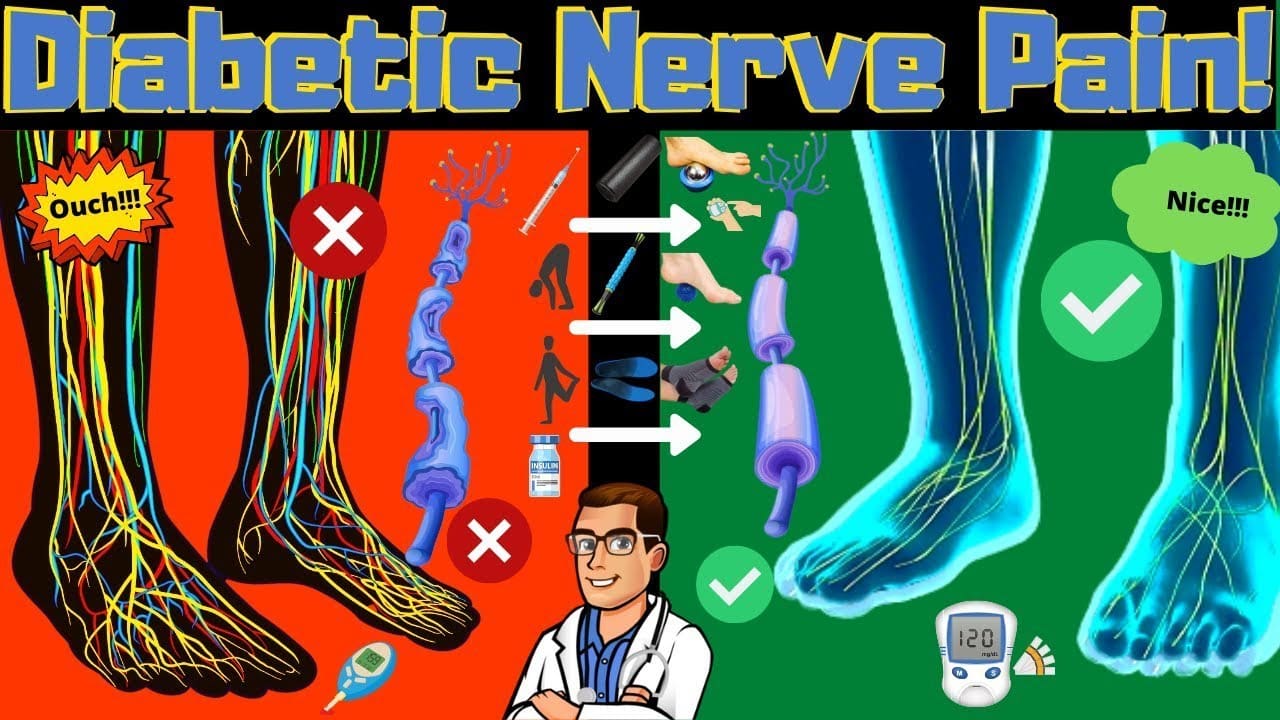 diabetic peripheral neuropathy treatment