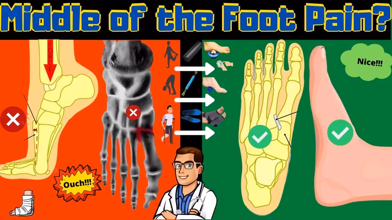 Lisfranc Injury Treatment Recovery Time Middle Foot Pain Cure 2 - Balance Foot & Ankle