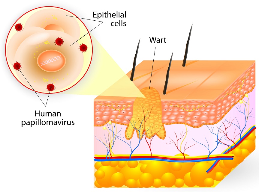 red bump on foot, white bumps on foot