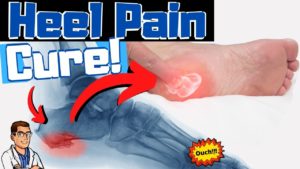 Heel Pain Foot Doctors