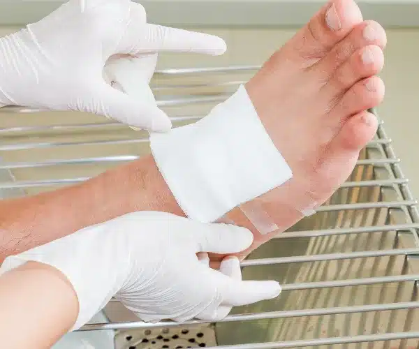 foot wound care