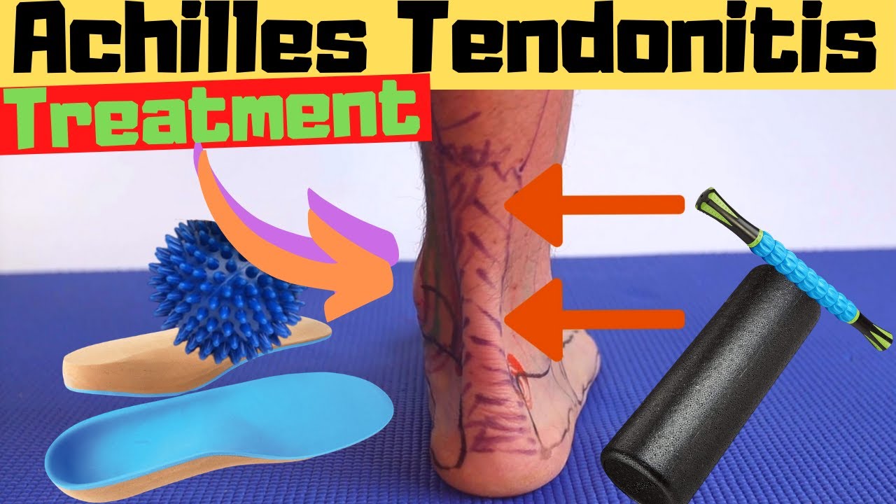 BEST Sandals for Achilles Tendonitis 