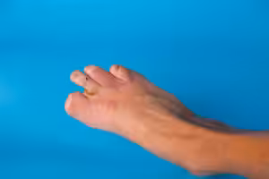 can you still walk without a big toe​