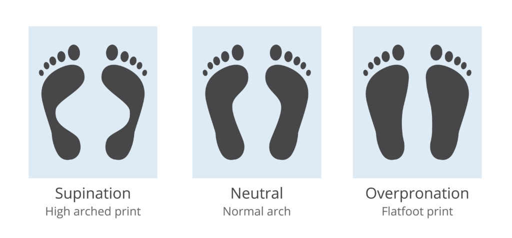 Inside of the arch pain that is not plantar fasciitis