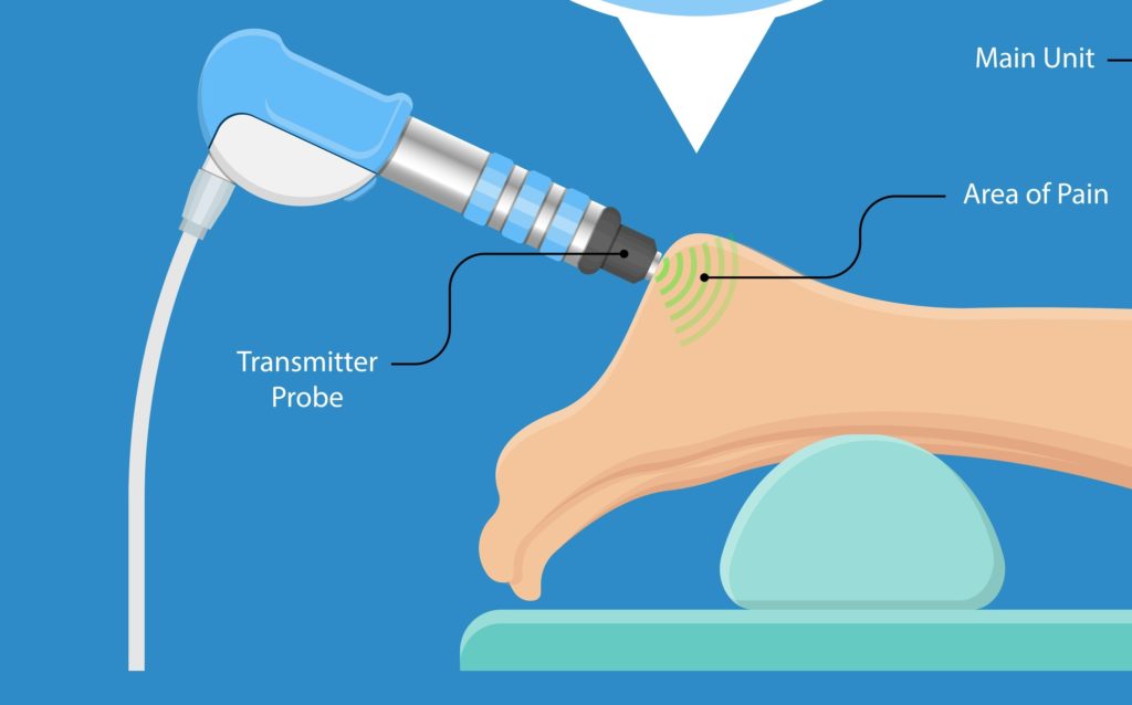 How much does shockwave therapy cost?