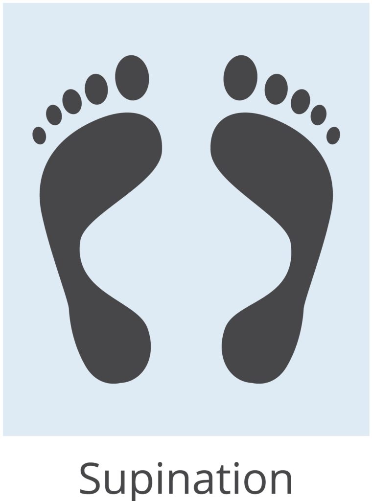 Overpronation Flat Feet Pain Treatment 13 ankle overpronation